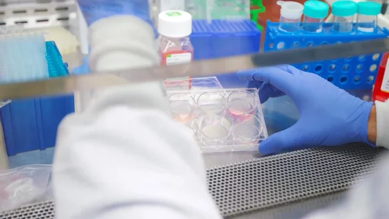 UCLA Center for Rare Diseases intro video