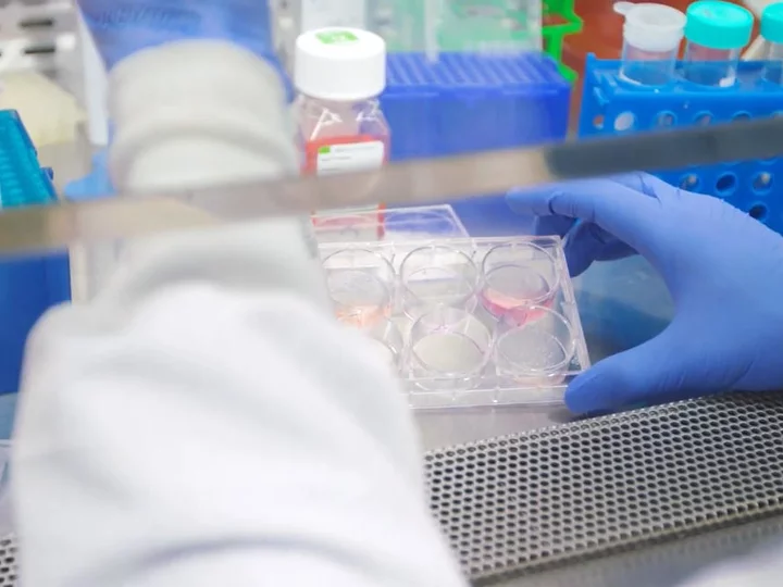 UCLA Center for Rare Diseases intro video